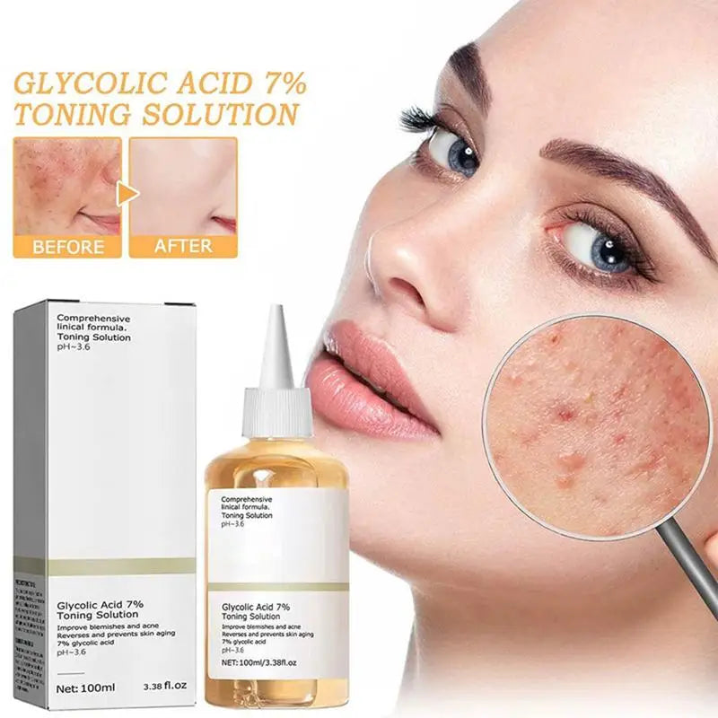 7% Glycolic Acid Toner Remove Acne Fade